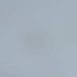 Hymenolepiasis. egg of Hymenolepis nana. microscopic detection in faeces. the eggs are 40-50 µm i...