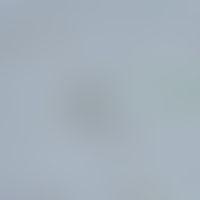 Hymenolepiasis. egg of Hymenolepis nana. microscopic detection in faeces. the eggs are 40-50 µm i...