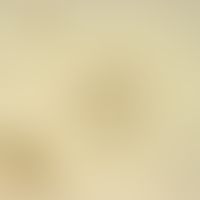 Hymenolepiasis. Egg of Hymenolepis diminuta. The polar filaments are missing here. The egg is lar...