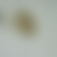 Diphyllobothriasis. Ei von Diphyllobotrium latum. Nicht embryoniertes, gedeckeltes Ei.