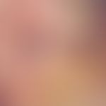 Verschiebelappenplastik, transversale. Abb. 1 b: Postoperative Nahtverhältnisse nach transversale...