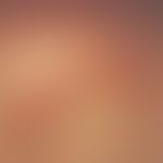 Simultaneous excision. Fig. 2 a: Protrusion of the skin by a fist-sized subcutaneous tumor in the...