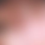 Incision, faulty. fig. 10 a: Nodular, superficially slightly eroded tumor, interspersed with tela...
