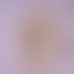 Fasciolopsiasis. egg of Fasciolopsis buski. the egg is very similar to the egg of Fasciola hepati...