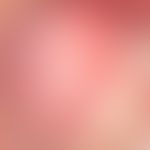 Anoscopy, high-resolution, inconspicuous transformation zone (linea dentata) without clinically v...