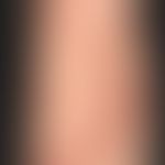 Wunde, chronische. Artefakte
