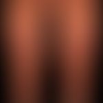 Necrobiosis lipoidica: sharply delimited, confluent marginal, reddish-brownish, centrally faded, ...