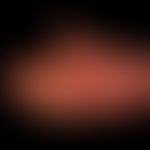 Epidermolysis bullosa hereditaria. (Hallopeau-Siemens). Flächige Atrophie der Haut der Hände.

