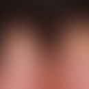 Zwanzig-Nägel-Dystrophie:&nbsp;Befall sämtlicher Nägel (20-Nägel-Syndrom); aufgeraute, verdünnte ...