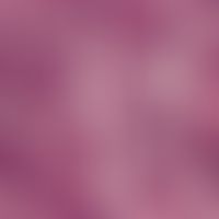 Cylindrome. sharply defined basaloid cell complexes surrounded by a broad eosinophilic (PAS-posit...