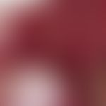 Cyst. 1.0 cm large, painless, bulging node of the pharyngeal mucosa in the region of the arcus pa...