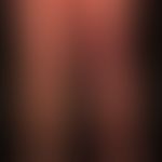 Lyme borreliosis: Late stage picture of acrodermatitis chronica atrophicans
