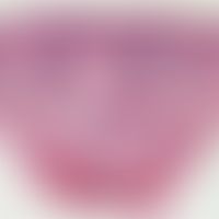 lymphocytic infiltration of the skin. dense, superficial and in places also deep, spot-like, peri...