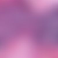 Lymphocytic infiltration of the skin. detail: densely staggered infiltrate of small lymphocytes. ...