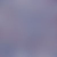 Lymphom, kutanes. Immunhistologische Aufarbeitung von kutanen Infiltraten eines B-Zell-Lymphoms. ...