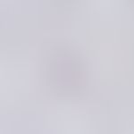 Blood smear:Plasmodium vivax: Schizont in the phase of division into merozoites (approx. 16 daugh...