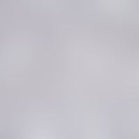 Malaria. blood smear: Plasmodium vivax: young trophozoite with ring form. typical amoeboid ("viva...