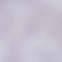 Malaria. blood smear: Plasmodium malariae: stage of schizophrenia and division into merozoites. i...