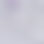 malaria. blood smear: plasmodium falciparum: trophozoites with typical ring forms, partly multipl...