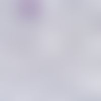 malaria. blood smear: plasmodium falciparum: trophozoites with typical ring forms, partly multipl...