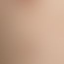 Mammilla, accessory. 0.6 cm large, brown, felted plaque with a central, pointed conical papule, c...