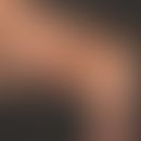 Marfan Syndrom: Übertreckbarkeit der Gelenke.
