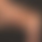 Marfan Syndrom: Übertreckbarkeit der Gelenke.
