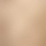 Drug reaction, fixed: suddenly appeared, for 3 days existing, erythematous, isolated, roundish, s...