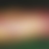 Candida-Granulom. Rezidiv an der Unterarm-Streckseite bei einem 28-jährigen Patienten 1 Jahr nach...