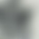 Candida sepsis; large blastospores and pseudomycelium in candida sepsis; kidney; GMS staining (PD...