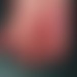 Candidose, chronisch-mukokutane (CMC). Ödematöse Schwellung des Daumens und Zeigefingers bei eine...