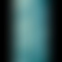 Candidose, enterale. Ösophagusbreischluck bei intestinaler Candidose.