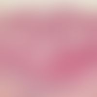 pustulose, subcorneal. large, intraepithelially located, single-chambered macropustule whose uppe...