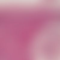 pustulose, subcorneal. detail enlargement (lateral upper border of the pustule): the content of t...
