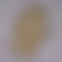 storage mites. detail enlargement of a storage mite. the females have a claw at each foot end. at...