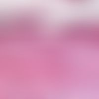 Toxische epidermale Nekrolyse. Frische Läsion mit beginnender intrapethelialer nekrobiotischer Bl...