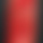 Toxic epidermal necrolysis. emergency hospitalization of a highly febrile (temp. 39.5 °C) 78-year...