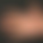 Kontaktdermatitis, toxische: Übersichtsaufnahme: Hyperkeratotisch-rhagadiformes Ekzem der Palma b...