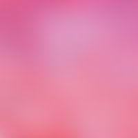 Graft-versus-Host-Disease. Bildausschnitt; atrophisches Epithel, Orthokeratose, Ödem der oberen D...