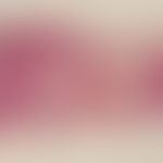 Hyperplasia, intravascular, papillary, endothelial. Vessel with intravascular proliferation. Narr...
