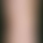 Kaposi's sarcoma endemic. asymptomatic, reddish to livid spots and papules as well as oedema. smo...