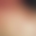 Blutegeltherapie. Hämorrhagische Rundherde mit zentralem Blutpunkt nach Blutegeltherapie im Nacke...