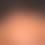 Alopezie postmenopausale, frontale, fibrosierende: gleichmäßiges&nbsp;Zurücktreten der frontalen&...