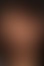 Alopecia areata:&nbsp;rundliche, sich zentrifugal und medial ausbreitende, glatte, hautfarbene, h...