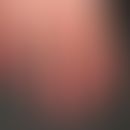 Acrocyanosis in age-atrophied, shiny skin, alternating temperature-dependent colouring from mediu...