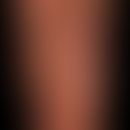 psoriasis palmaris et plantaris (pustular type): extensive erythema of the entire palm. sharply l...