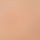 Café-au-lait stains: in neurofibromatosis type I. 2 medium brown homogeneously coloured light bro...