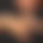 Ehlers-Danlos-Syndrom:&nbsp;Überstreckbarkeit der Gelenke im Bereich der Hände.
