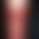 Erysipel bullöses:&nbsp;akute &nbsp;flächenhafte, scharf begrenzte, schmerzhafte Rötung und Plaqu...
