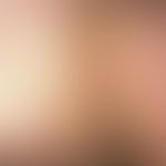 Fibroma molle. Zahlreiche, gestielte, pendulierende, weiche, hautfarbene oder leicht bräunliche, ...